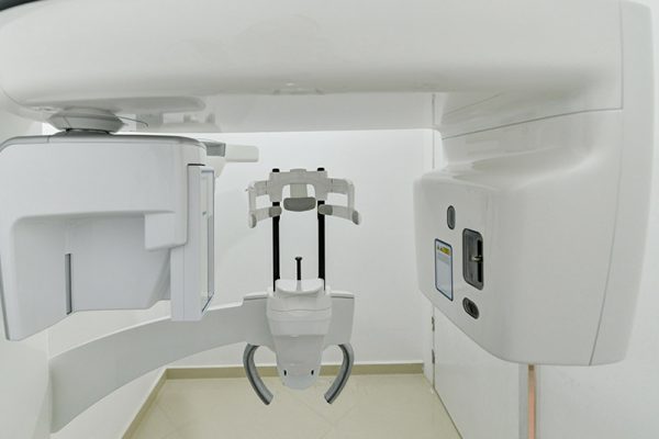 Radio 3D (CBCT)
